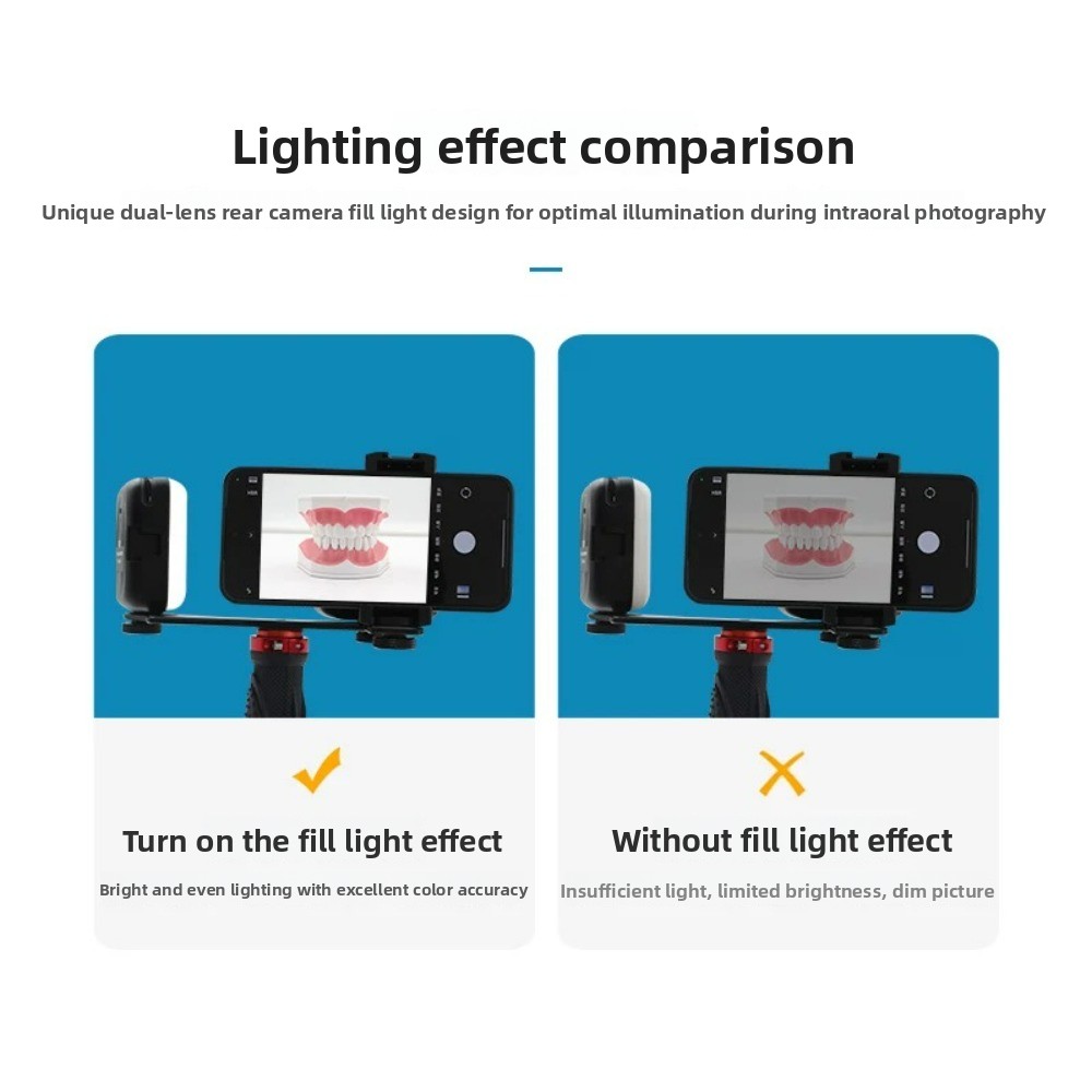 Dental Photography Light, Blue - đánh giá và giá Photography Led Lighting Kit